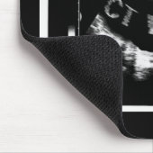 CT Well Mousepade  (CT Well im Bauch) マウスパッド (コーナー)