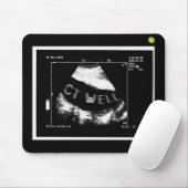 CT Well Mousepade  (CT Well im Bauch) マウスパッド (マウス)