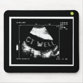 CT Well Mousepade  (CT Well im Bauch) マウスパッド