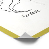 Curves of the Spineポスターカイロプラクティック ポスター (角)