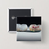 Daum、ナンシー、フランス著2つのボール 缶バッジ (正面&裏面)