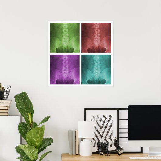 Digital X-Ray Pop Art Square Poster ポスター (ホームオフィス)