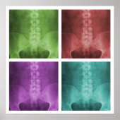 Digital X-Ray Pop Art Square Poster ポスター (正面)