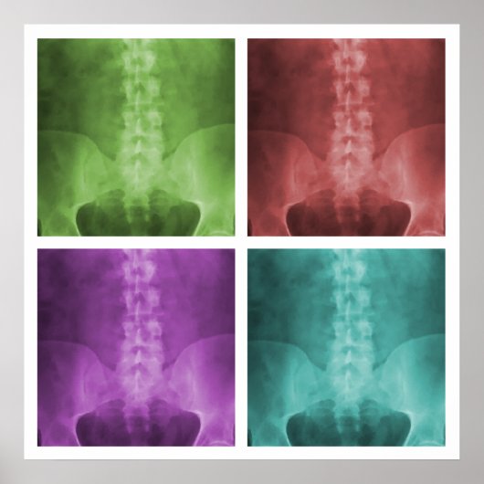 Digital X-Ray Pop Art Square Poster ポスター (正面)