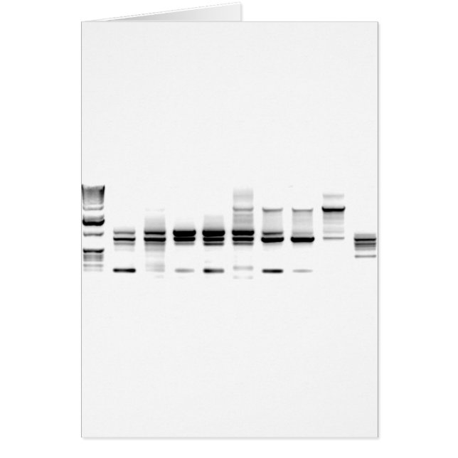 DNAのゲル (正面)