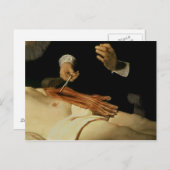 Dr. Nicolaes Tulpの解剖学のレッスン， 1632 ポストカード (正面/裏面)