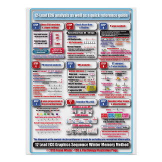 ECGトレーニングポスター ポスター