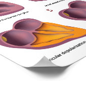 ECGハート電気活動ポスター ポスター (角)