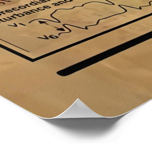 ECG Knowledge Poster, Cardiology Knowledge Poster ポスター (角)