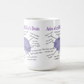 ER医おもしろい医ギフト2トーンのコーヒーMu コーヒーマグカップ (中央)