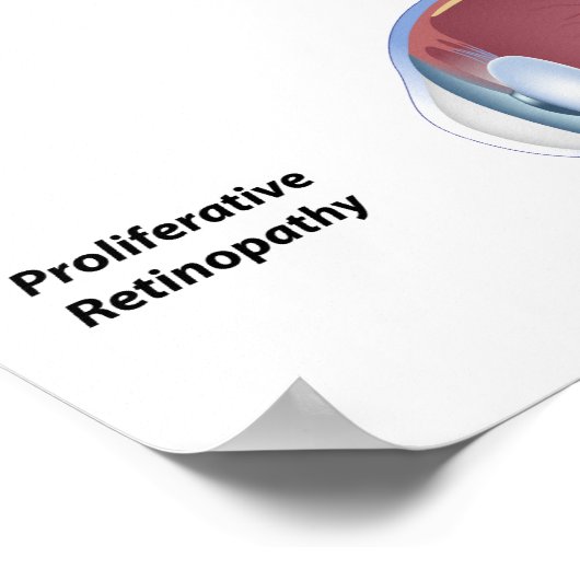 Eye disease Diabetic retinopathy Poster ポスター (角)