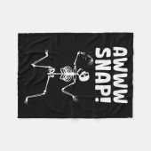 Funny Broken Arm Design For Men Women Broken Arm R フリースブランケット (正面(横))