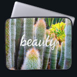 Fuzzy Green Cacti多肉性フォト美しいスクリプト ラップトップスリーブ<br><div class="desc">サボテンは最も厳しい砂漠の環境で繁栄する。この写真のネオプレン日を使用するたびに、晴れたラップトップスリーブと夏の庭の美しいの夢素晴らし。この来ラップトップスリーブは15インチ、13インチ、10インチの3つのサイズ。特別な素晴らし人に贈り物を！あなたは簡単にこのネオプレンラップトップスリーブをパーソナライズすることができ、私はまた、任意の製品にカスタマイズを提供する。質問や要望があれば私に連絡して下さい。</div>