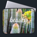 Fuzzy Green Cacti多肉性フォト美しいスクリプト ラップトップスリーブ<br><div class="desc">サボテンは最も厳しい砂漠の環境で繁栄する。この写真のネオプレン日を使用するたびに、晴れたラップトップスリーブと夏の庭の美しいの夢素晴らし。この来ラップトップスリーブは15インチ、13インチ、10インチの3つのサイズ。特別な素晴らし人に贈り物を！あなたは簡単にこのネオプレンラップトップスリーブをパーソナライズすることができ、私はまた、任意の製品にカスタマイズを提供する。質問や要望があれば私に連絡して下さい。</div>