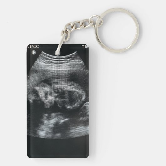 Gift for Dad-to-be Note from baby Custom Photo  キーホルダー (裏面)