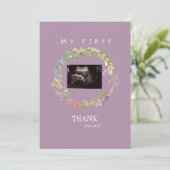 Girl Ultrasound Photo Thank YouベビーPoint of View サンキューカード (スタンド正面)