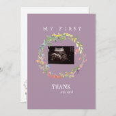 Girl Ultrasound Photo Thank YouベビーPoint of View サンキューカード (正面/裏面)