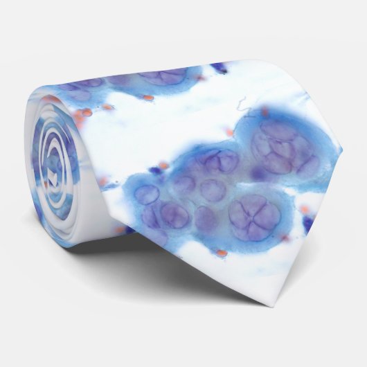 HSVのEsophagitis -ブラシ ネクタイ (ロール)