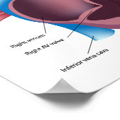 Human Heart Anatomy Poster ポスター (角)
