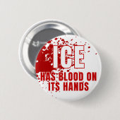 ICEはゲシュタポ トランプ反対 缶バッジ (正面&裏面)