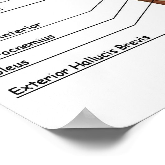 IFA解剖図 ポスター (角)