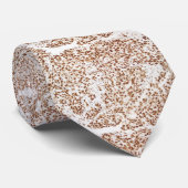 Immunohistochemistry -不適当な組み合わせ修理蛋白質 ネクタイ (ロール)