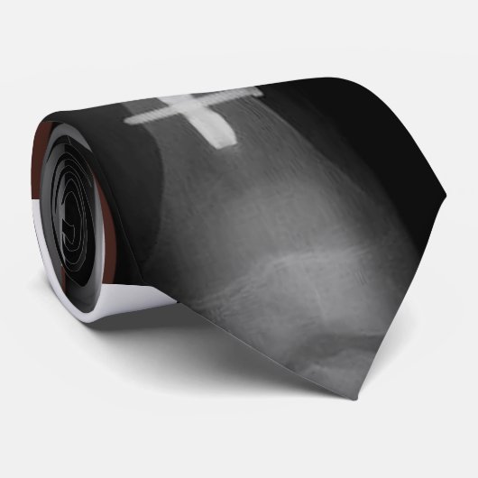 Intramedullaryネイルとの腿骨のひび ネクタイ (ロール)