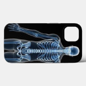 John Doe X-ray iPhone / iPadケース Case-Mate iPhoneケース (裏面 (横))