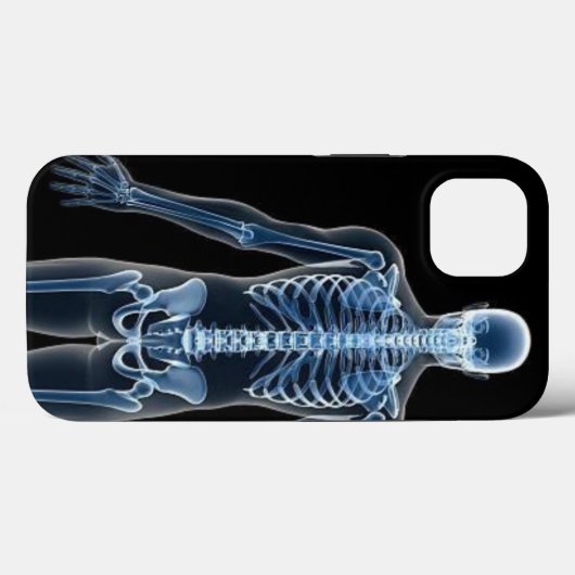 John Doe X-ray iPhone / iPadケース Case-Mate iPhoneケース (裏面 (横))