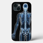 John Doe X-ray iPhone / iPadケース Case-Mate iPhoneケース (裏面)