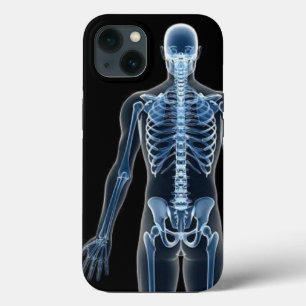 John Doe X-ray iPhone / iPadケース 13ケース