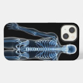 John Doe X-ray iPhone / iPadケース iPhoneケース (裏面横)