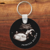 KG_妊娠ベビー超音波写真 キーホルダー (正面)