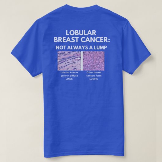 LBCA Ask Me About Lobular Breast Cancer Tシャツ (デザイン裏面)