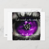 lupus eye22.jpg ポストカード (正面/裏面)