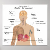 Main Symptoms of Acute HIV Infection ポスター (正面)