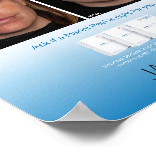 Marini Peel System 8x10インチ ポスター (角)