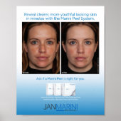 Marini Peel System 8x10インチ ポスター (正面)