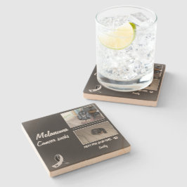 Melanoma Pet Memorial Photo Layout ストーンコースター