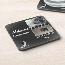 Melanoma Pet Memorial with Two Photos コースター