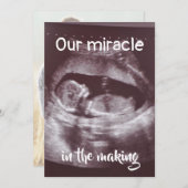 Miracle In Making Ultrasound 2 Photoベビー 案内状 (正面/裏面)