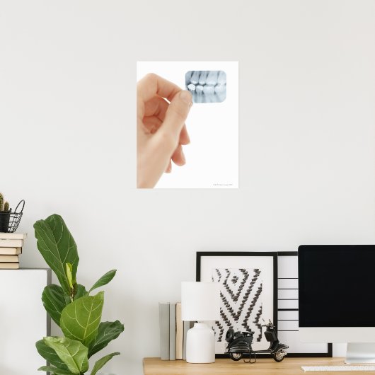 MODEL RELEASED. Dental X-ray. ポスター (ホームオフィス)