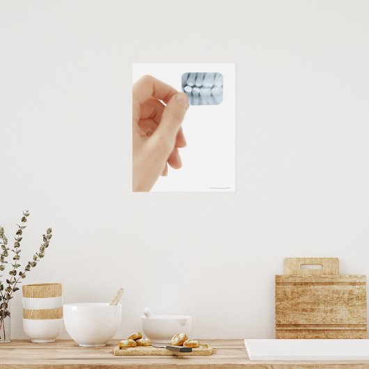 MODEL RELEASED. Dental X-ray. ポスター (キッチン)