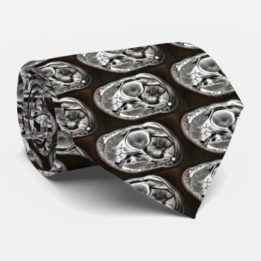 MRIのタイ ネクタイ (ロール)