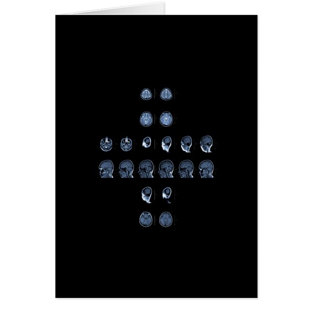 MRIの十字 (正面)