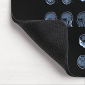 MRIの十字 マウスパッド (コーナー)