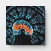 MRI脳スキャン フォトプラーク (正面)