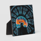 MRI脳スキャン フォトプラーク (正面)