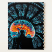 MRI脳スキャン プランナー手帳 (裏面)