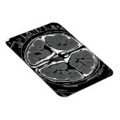 MRI脳スキャン マグネット (右側)